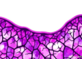 Bacterial Signatures in Prostate Tissue Linked to Cancer in Landmark French Study