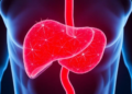 Scientists Uncover a Sugar-Burning Switch That Drives Liver Scarring