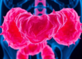 Collagen Scaffold in Tumors Primes Colorectal Cancer Cells to Evade Chemotherapy