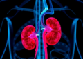 Lactate emerges as both warning sign and driver of kidney injury after heart surgery