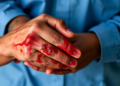Ebola Survivors With Lasting Illness Show Distinct Metabolic Fingerprints in Blood