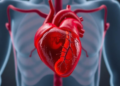 When Heart, Liver and Metabolism Collide: A Deadly Syndemic That Cuts Years Off Life
