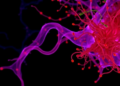 Aging Fibroblasts Fuel Ovarian Cancer Growth Through a Single Secreted Protein