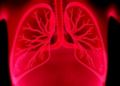 Fetal Lung Drainage Saves Two-Thirds of Babies With Fluid-Filled Chests, Major Review Finds