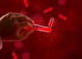 Blood Test Combining Cytokines and Vitamin D Could Flag Complex Febrile Seizures in Children