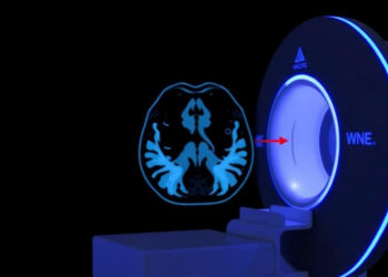 AI-Designed PET Probe Reaches First Human Test for Imaging PARP-1 in Cancer
