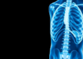 Old Antibiotics, New Trick: Doxycycline Blocks Prostate Cancer Spread to Bone