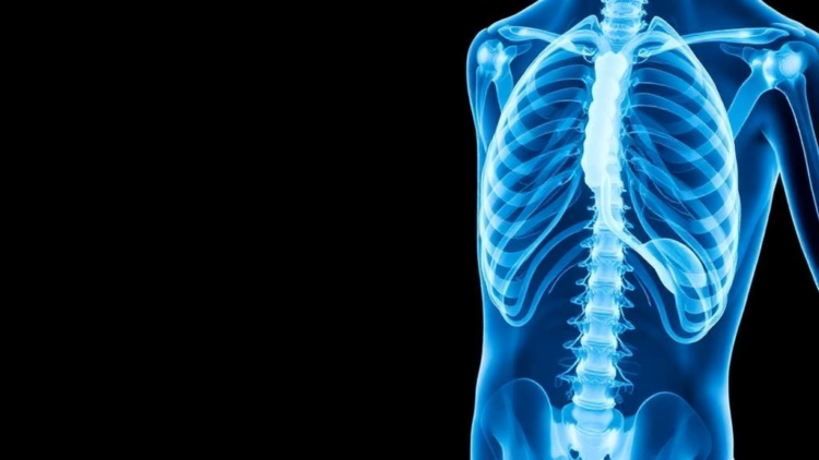 Old Antibiotics, New Trick: Doxycycline Blocks Prostate Cancer Spread to Bone