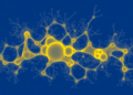 Proteomic Map of Cervical Cancer Reveals Subtypes and a New Drug Target