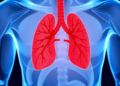 High Ferritin Levels Flag Deadly Risk in Tuberculosis Patients with Low Blood Counts