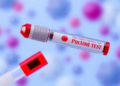Simple Blood Test Ratio Predicts Survival in Hodgkin Lymphoma Patients on Immunotherapy