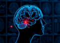 AI That Reads Brain Scans and Medical Records Boosts Alzheimer's Diagnosis