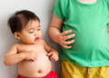 Childhood Obesity and Eczema: Systematic Review Probes a Growing Immune Link