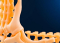 AI Learns to Measure New Bone Growth in Scaffolds, But Standard Metrics Mislead