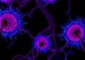 Silencing a Fat-Making Master Switch Pushes Pancreatic Cancer Cells Toward Self-Destruction