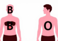 Blood Type May Shape Diabetes Risk: Group B Linked to Higher Odds, Group O to Protection