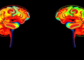 Brain Maps Reveal Hidden Differences in How Autistic Children Process Seeing and Hearing Speech