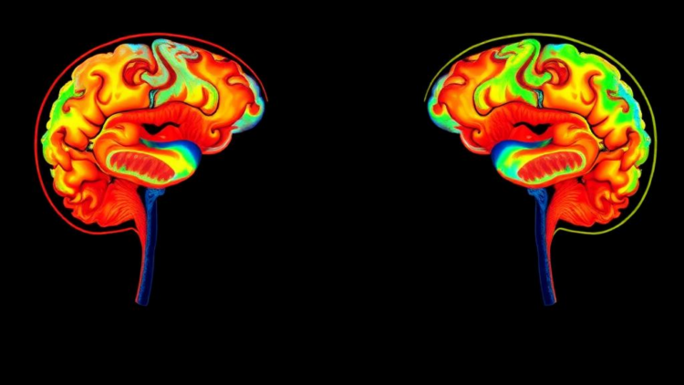 Brain Maps Reveal Hidden Differences in How Autistic Children Process Seeing and Hearing Speech