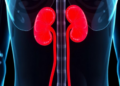 High Blood Pressure Raises Kidney Injury Risk During Modern Cisplatin Chemotherapy