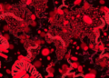 Massive Blood RNA Atlas Maps Molecular Fingerprints of 98 Human Diseases