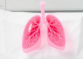 Faster PCR Results in Ventilator-Associated Pneumonia May Not Speed Up Antibiotic Decisions