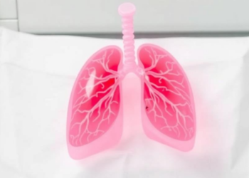 Faster PCR Results in Ventilator-Associated Pneumonia May Not Speed Up Antibiotic Decisions