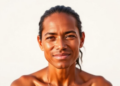 Skin Quality of Life Score Passes Its Toughest Cross-Country Test Yet