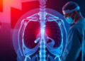 Five-Session Radiation Matches Surgery in Long-Term Prostate Cancer Control Trial