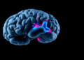 Hearing Loss in Aging Weakens the Brain's Wiring, Massive Scan Study Finds