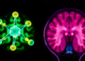 Metal-Free Water-Soluble Molecule Shines in Fluorescence and MRI Imaging