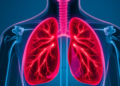 AI Chatbot Beats Web Search at Helping Laypeople Diagnose Respiratory Illness