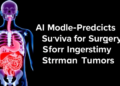 AI Model Predicts Survival After Surgery for Gastrointestinal Stromal Tumors