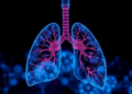 c-MET Signaling Reshapes the Lung Cancer Immune Landscape in Space and Metabolism