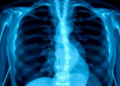 AI Learns to Fake Chest X-Rays So Well It Boosts Disease Diagnosis to Near Perfection