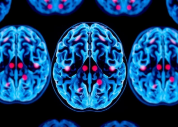 Scientists Find a Vulnerable Window When Brain Metastases Can Still Be Stopped