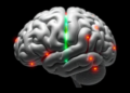AI Model Reads Gray and White Matter Signals to Spot Autism with 87% Accuracy