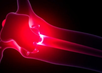 Simple Blood Score Predicts Failure and Death After Joint Replacement Infection Surgery