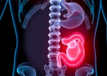 ChatGPT-5 Outperforms Classic Alvarado Score in Detecting Appendicitis, Study Finds