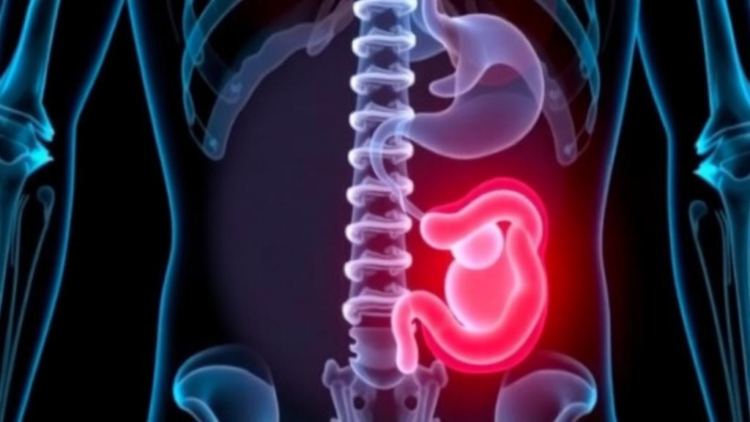 ChatGPT-5 Outperforms Classic Alvarado Score in Detecting Appendicitis, Study Finds