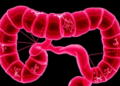 Misplaced Gap Junction Protein Drives Colorectal Cancer Spread—and Reveals a Drug Weakness
