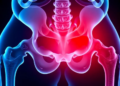 Retracted Osteoarthritis Study Shows How Duplicated Images Unravel a Paper
