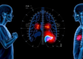 Radiologists Sound the Alarm on the World Standard for Staging Childhood Liver Cancer
