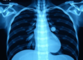 Adult AI Learns to Read Newborn Chest X-rays by Travelling Between 30 Hospitals