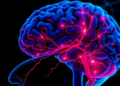 Pericyte Loss and Inflamed Blood Vessel States Revealed in Brain Small Vessel Disease
