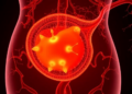 The Gas That Regulates Pregnancy: A Landmark Map of Hydrogen Sulfide Research Reveals a Half-Empty Picture of the Placenta