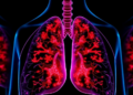 Virtual Tumors Point to New Drug Combinations for Hard-to-Treat Lung Cancer Mutations