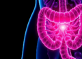 Blocking FGFR Signaling Supercharges Immunotherapy in Hard-to-Treat Colorectal Cancer
