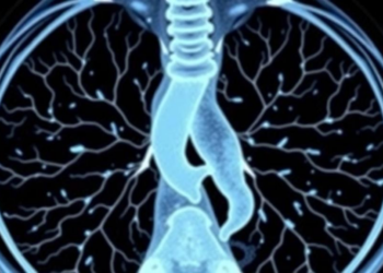 Automated CT Scans Give Doctors a New Window Into a Rare Cystic Lung Disease