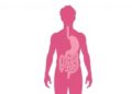 Gut Before Skin: IBS Tends to Precede Rosacea in Landmark Timing Study