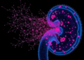 Single-cell map shows how pancreatic cancer clones evolve to outsmart treatment